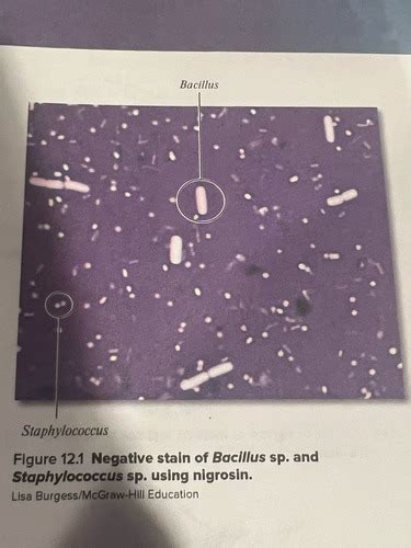 Gram Stain Acid Fast Stain Capsule Stain Negative Stain And Spore