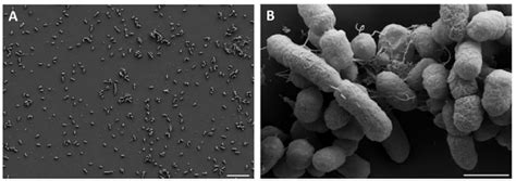 Microscopic Examination Of C Amalonaticus Cj A Sem Image Of Strain