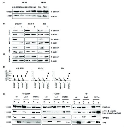 Western Blot analysis of β catenin expression in RMS tumor cell