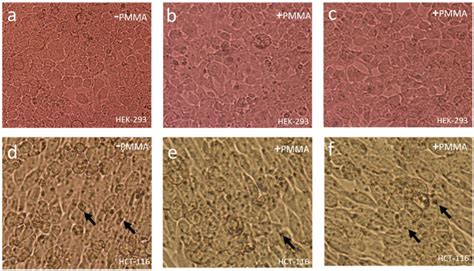 Cell Morphology of HEK-293 and HCT-116 cells after 24 h of treatment of ...