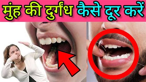 मुंह की दुर्गंध कैसे दूर करें Bad Breath Treatment What Causes Bad Breath Halitosis Bad Breath