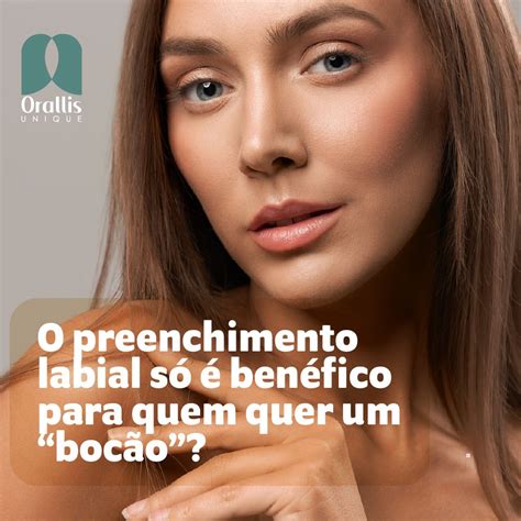 O Preenchimento Labial é Um Procedimento Estético Que Visa Melhorar O