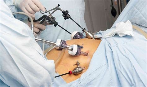 Advanced Laparoscopy Surgery in Kharghar | Alpha One Hospital