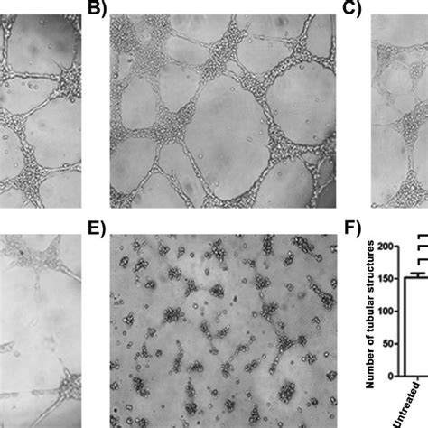 In Vitro Anti Angiogenic Activity Of GCCNPs AF Representative