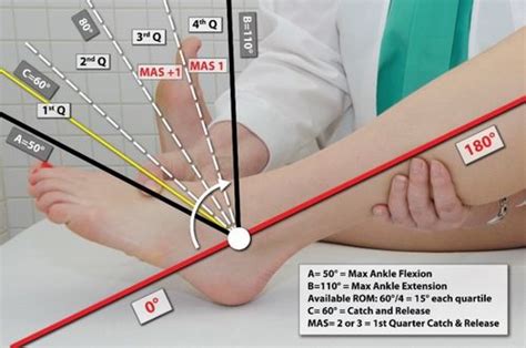 Spasticity Assessment Modified Ashworth Scale