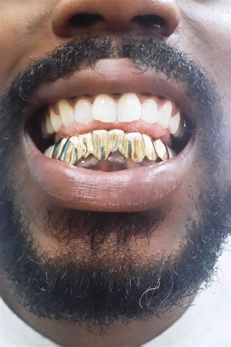 Gold Grillz Miami Grillz Diamond Grillz White Gold Grillz