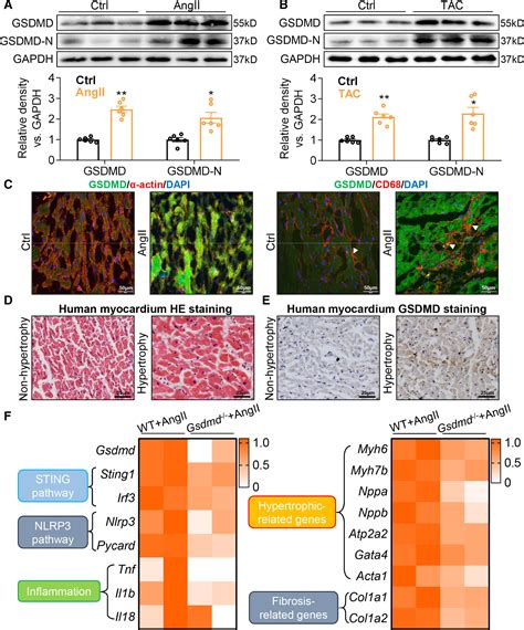 GSDMD Gasdermin D Mediates Pathological Cardiac Hypertrophy And