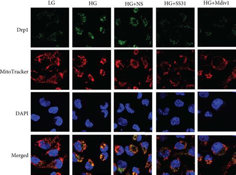 Effects Of Ss31 On Drp1 Mfn1 Caspase1 And Il 1β Protein Expression