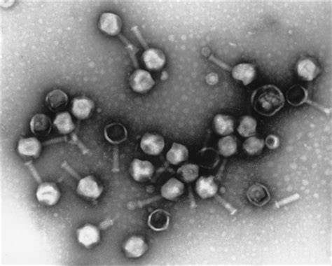 Bacteriophage Virus Electron Microscope