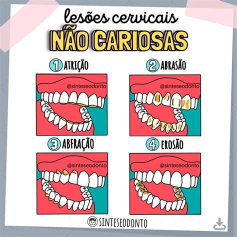 Les Es Cervicais N O Cariosas Dentistas Odontologia Tutoriais De