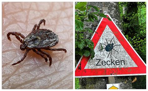 Schwarzwald Baar Immer mehr Infektionen durch Zeckenbisse SÜDKURIER