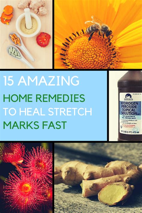 10 Most Effective Natural Remedies For Allergy Relief