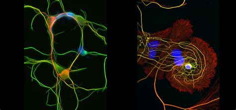 Home The Cytoskeleton Of Neurons And Glia