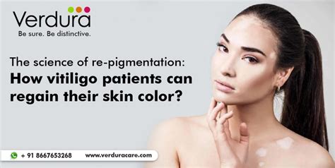 The Science Of Re Pigmentation How Vitiligo Patients Can Regain Their