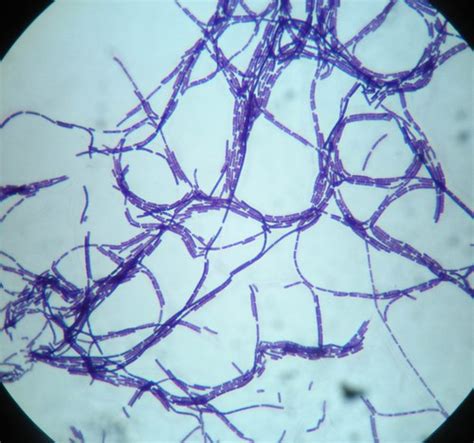 Bacillus Cereus Strep Bacillus Cereus Gram Positive Stain Lauren