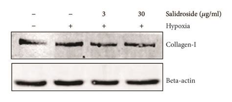 Salidroside Prevents Hypoxia Induced Increases In The Expression Of