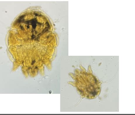 Written Lab Exam Material Parasites Flip Charts Mycology Flashcards