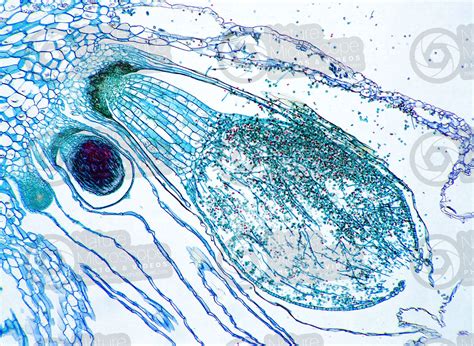 Marchantia polymorpha. Common liverwort. Sporophyte. Longitudinal section. 64X - Sporophyte ...