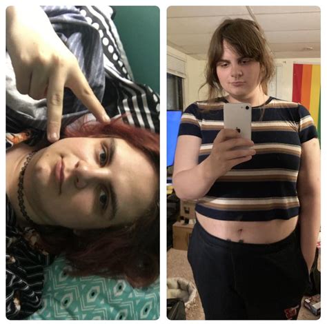 Final Pre Hrt Photo Left And Today 1 Yr Hrt Right R Transtimelines