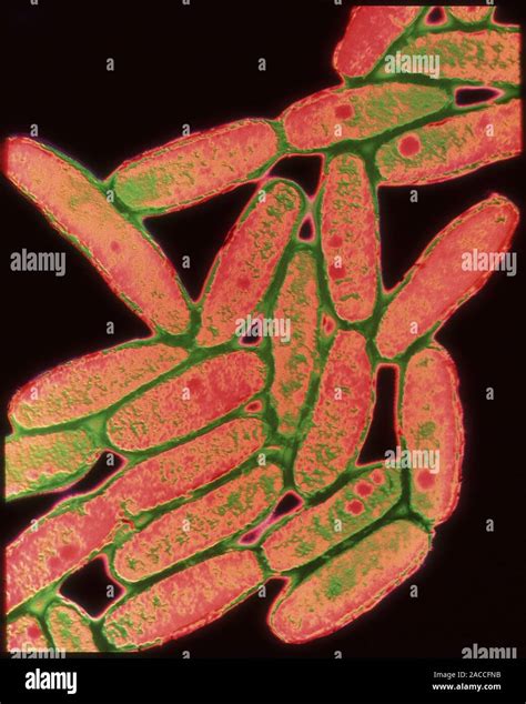 Legionella Coloured Transmission Electron Micrograph Of The Bacteria