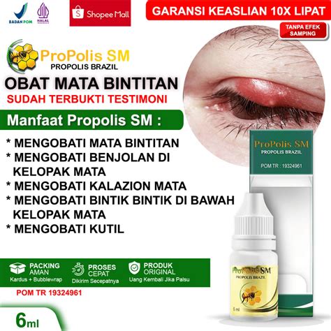 Jual Obat Mata Bintitan Kalazion Benjolan Di Kelopak Mata Bintitan Di