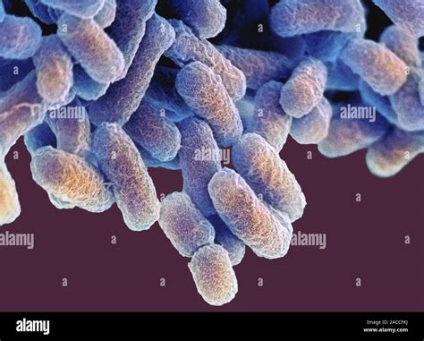 E Coli Bacteria Coloured Scanning Electron Micrograph Sem Of Escherichia Coli Bacteria E