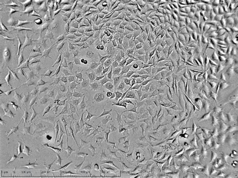 L Fibroblasr Cell Line Mouse Recording After Hours Etaluma Inc