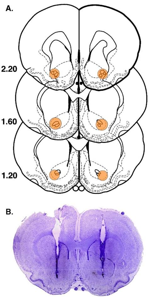 A Schematic Drawings Depicting The Areas Of The Nucleus Accumbens