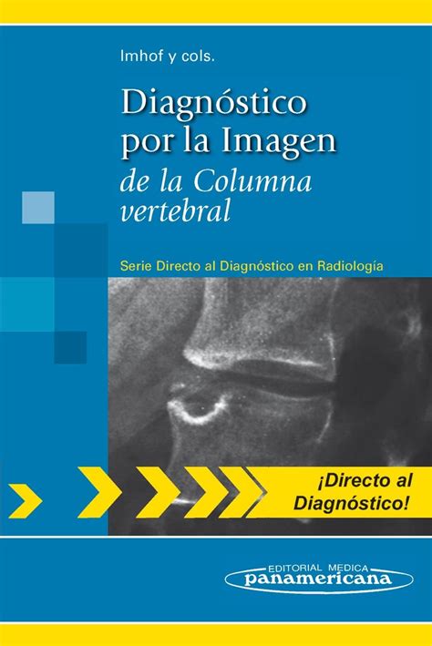 Diagnóstico por la imagen de la columna vertebral Serie Directo al