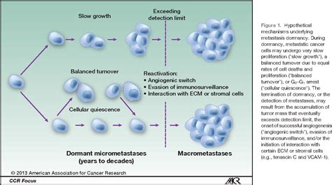 Figure 3 from Metastasis Dormancy in Estrogen Receptor–Positive Breast ...