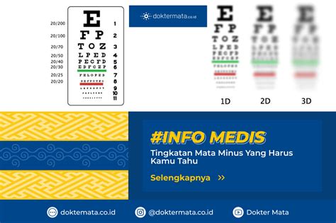 Tingkatan Mata Minus Yang Harus Kamu Tahu