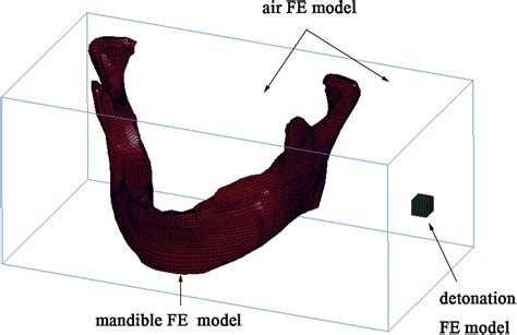 Blast Injuries To The Human Mandible Development Of A Finite Element