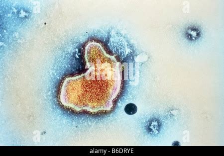 RESPIRATORY SYNCYTIAL VIRUS Stock Photo - Alamy