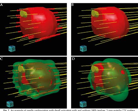 Figure 1 From The Impact Of Activating Source Dwell Positions Outside