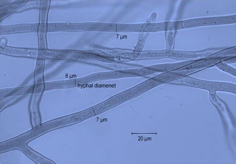 Hyphal Diameter Of R Solani Isolates Recovered From Tomato Download