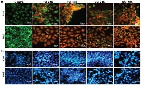 Fluorescence Based Cytotoxicity Assay And Chromatin Condensation