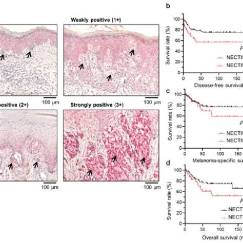 Nectin Is Expressed In Melanoma Tissues And Is Associated With Braf