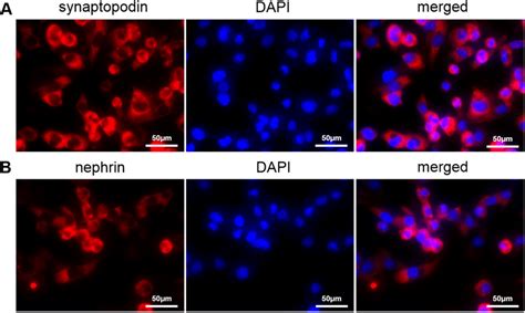 The Immunofluorescence Staining To Label Synaptopodin A And Nephrin B