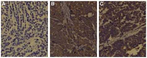 Immunohistochemical Staining Results Of Each Subcutaneous Tumor