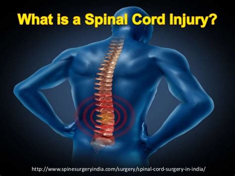 Spinal cord injury & treatment