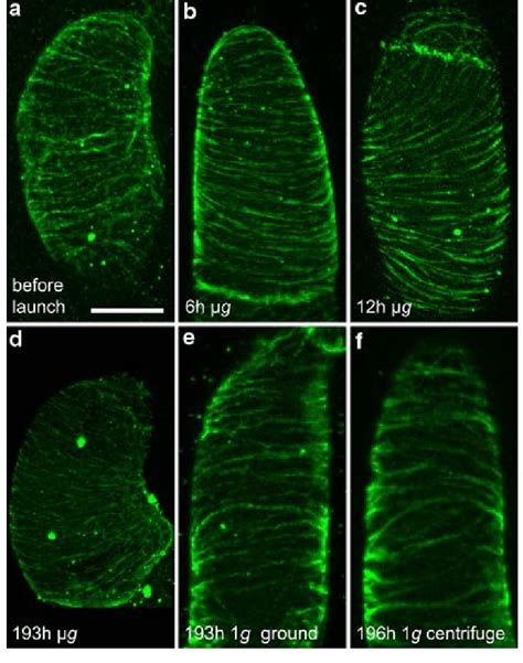 Cortical Microtubules In Interphase By 2 Cells That Were Chemically