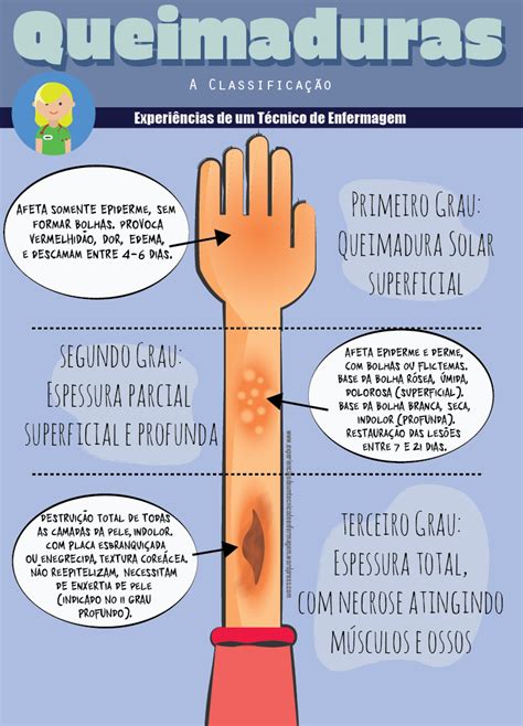 Queimaduras Classificações Enfermagem Ilustrada Enfermagem