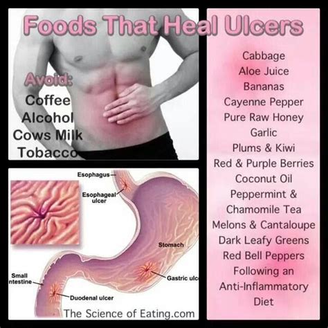 151 best H. pylori. ( stomach ulcers ) images on Pinterest | Stomach ulcers, H pylori symptoms ...