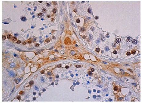 Anti Hif Antibody B Scbt Santa Cruz Biotechnology