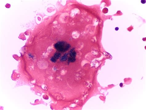 Gram Stain Interpretation - Microbiology and Immunology - Science Forums