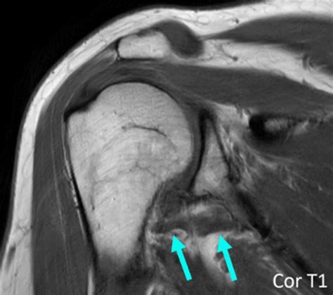 News Musculoskeletal Imaging Stanford Medicine