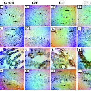 Representative Photomicrographs Of Ki 67 Immunohistochemical Stained