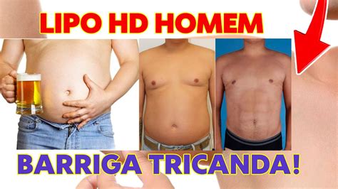 Lipo Hd Em Homens Youtube