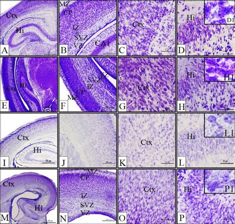 Representative Photomicrographs Of Cresyl Violet Stained Coronal