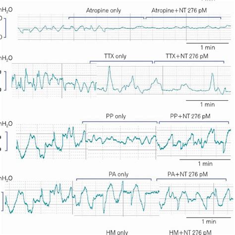 Concentration Response Curves For The Contractile Effect Of Neurotensin